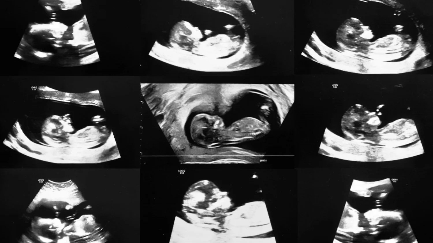 Matrescence (in development) 

Dir. Kathryn Ferguson