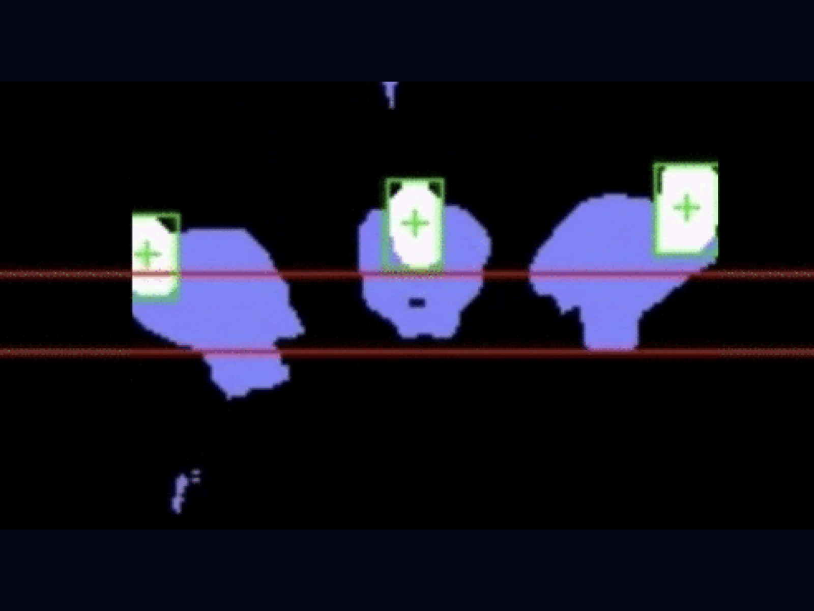 Microscopic image showing irregularly shaped blue structures with green cross markers and red lines across the image.