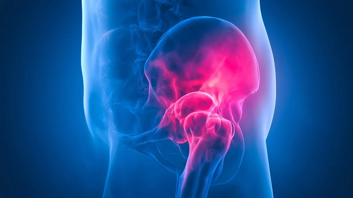 Hip Arthroscopy Phase 4: Preparing for strength