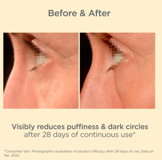 ISDIN-K-OX-Eyes-results.png
