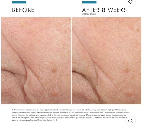 SkinCeuticals-Triple-Lipid-results.png