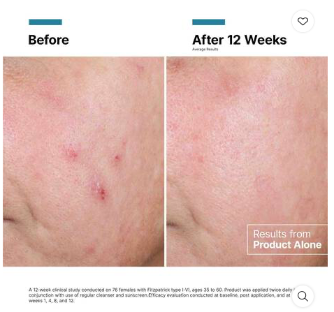 SkinCeuticals-Advanced-RGN-6-results.png