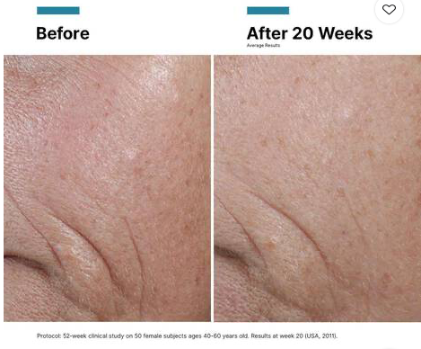 vitamin-c-ferulic-results.png