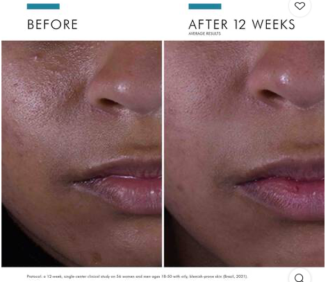 SkinCeuticals-Silymarin-CF-results.png