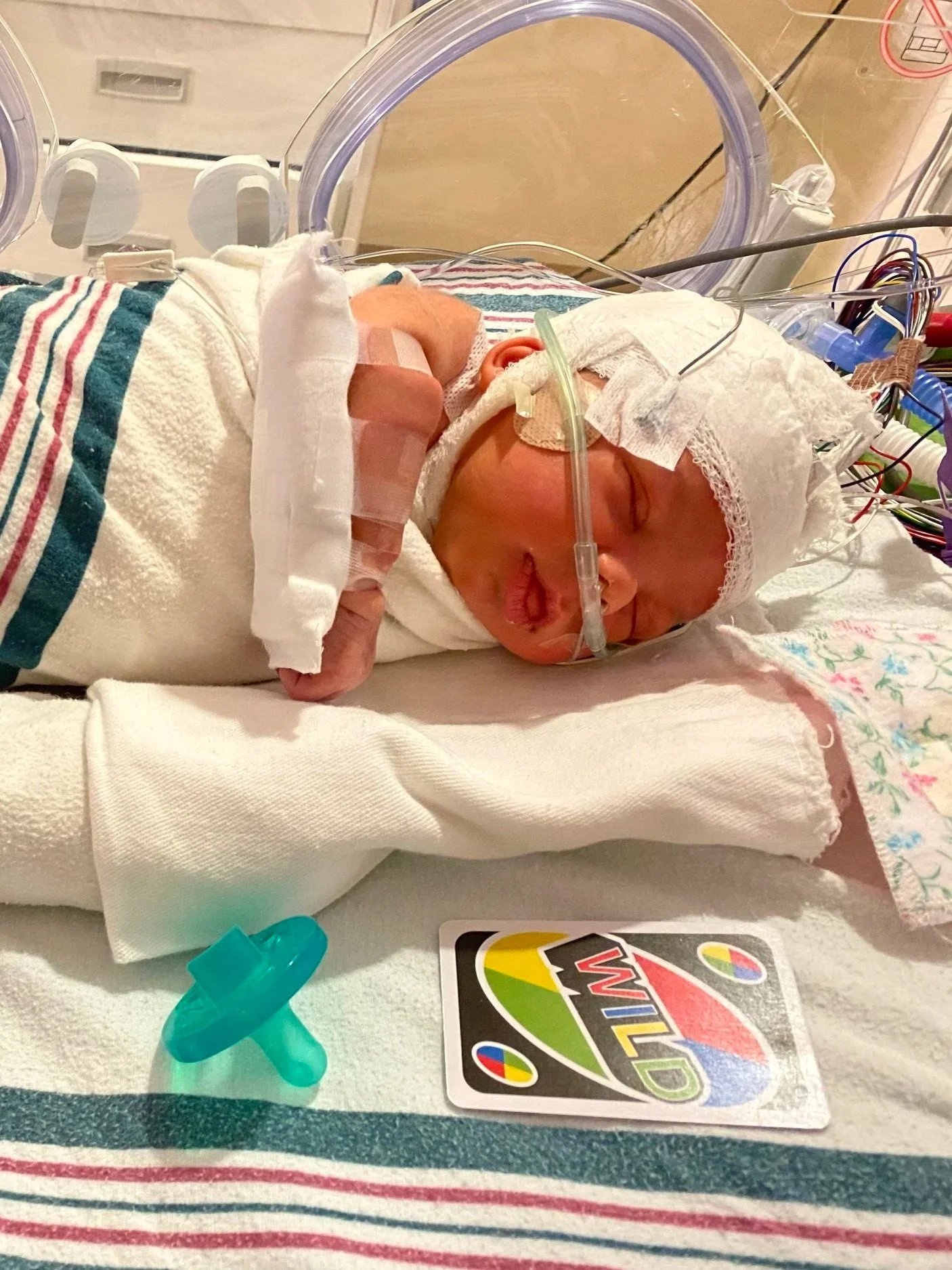 Liam during his NICU stay the day after he was born.