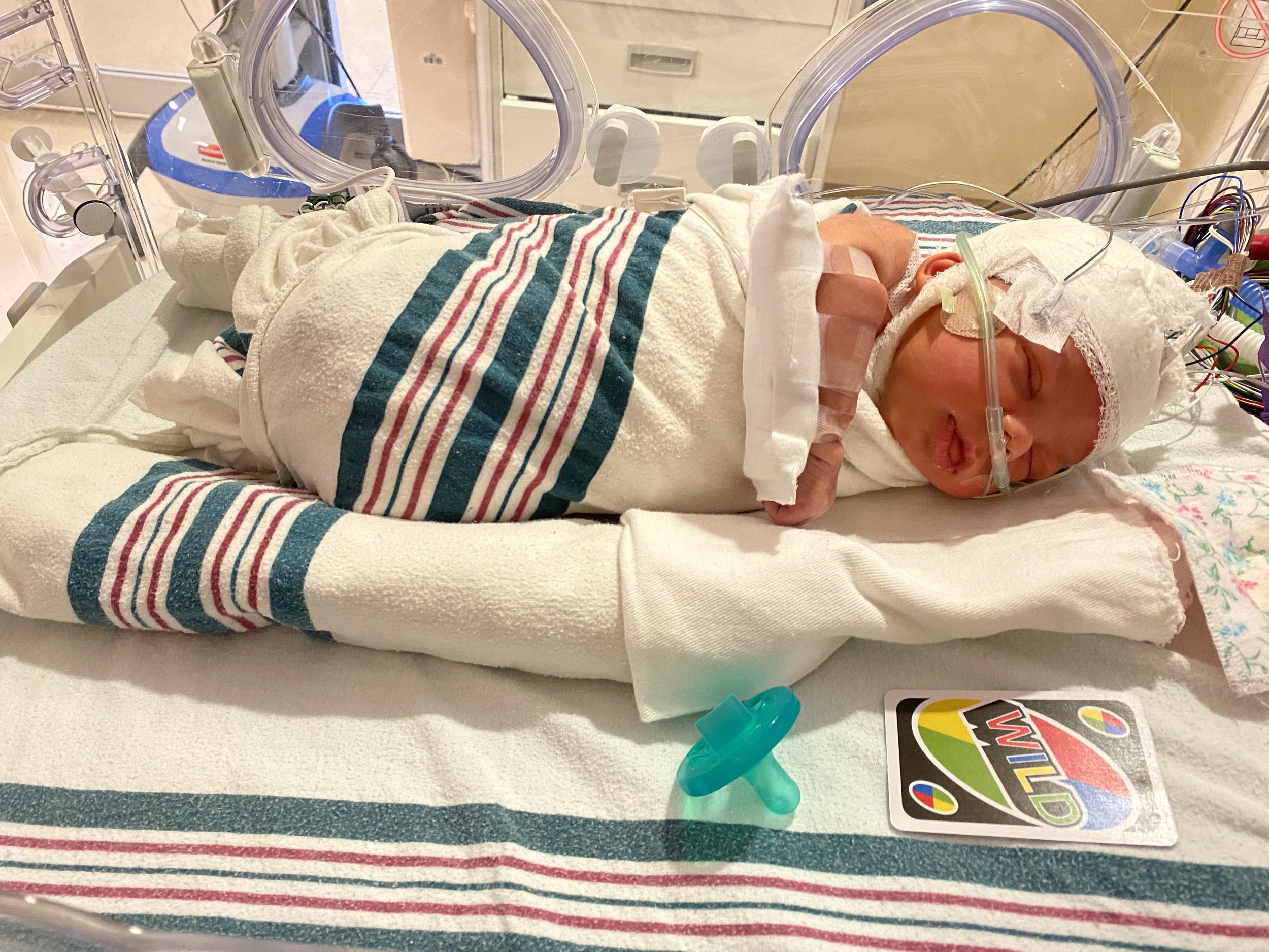 Liam during is NICU stay the day after he was born.