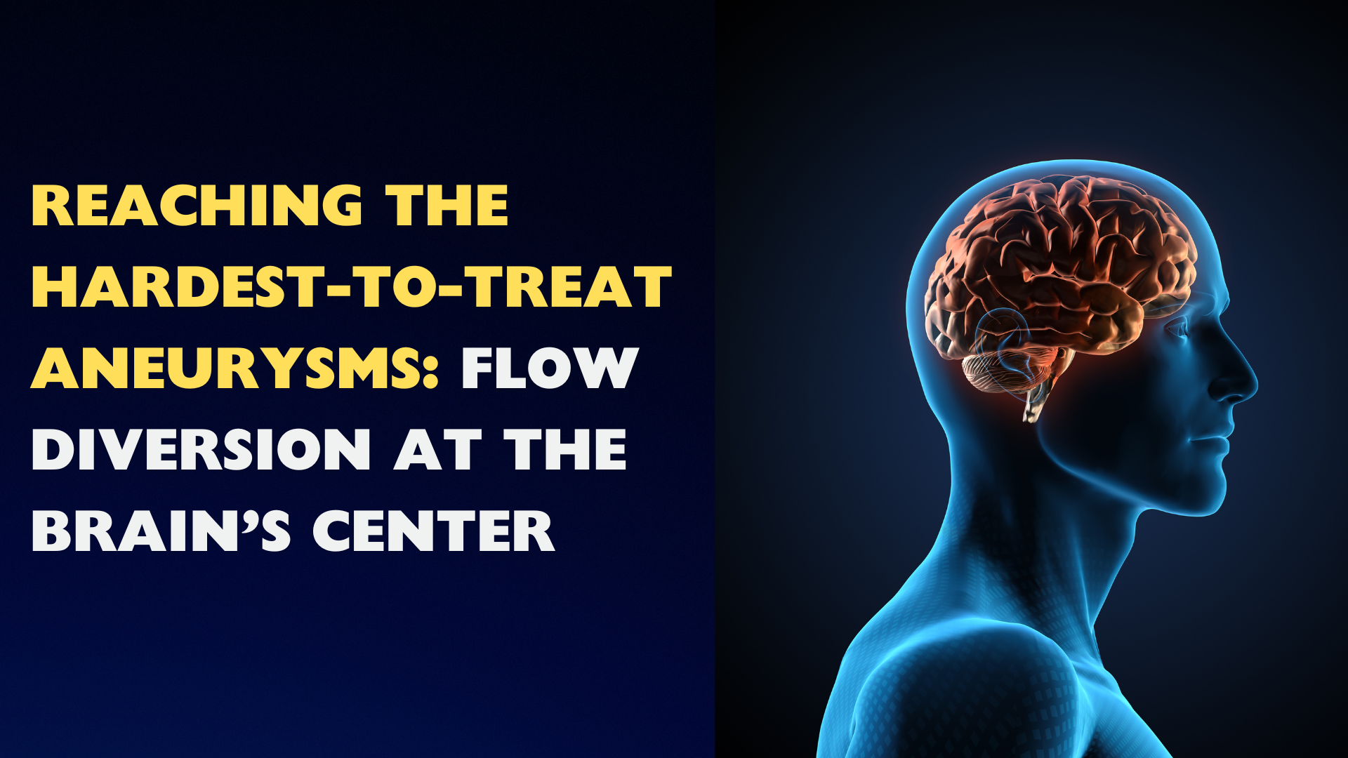 basilar apex aneurysm.png