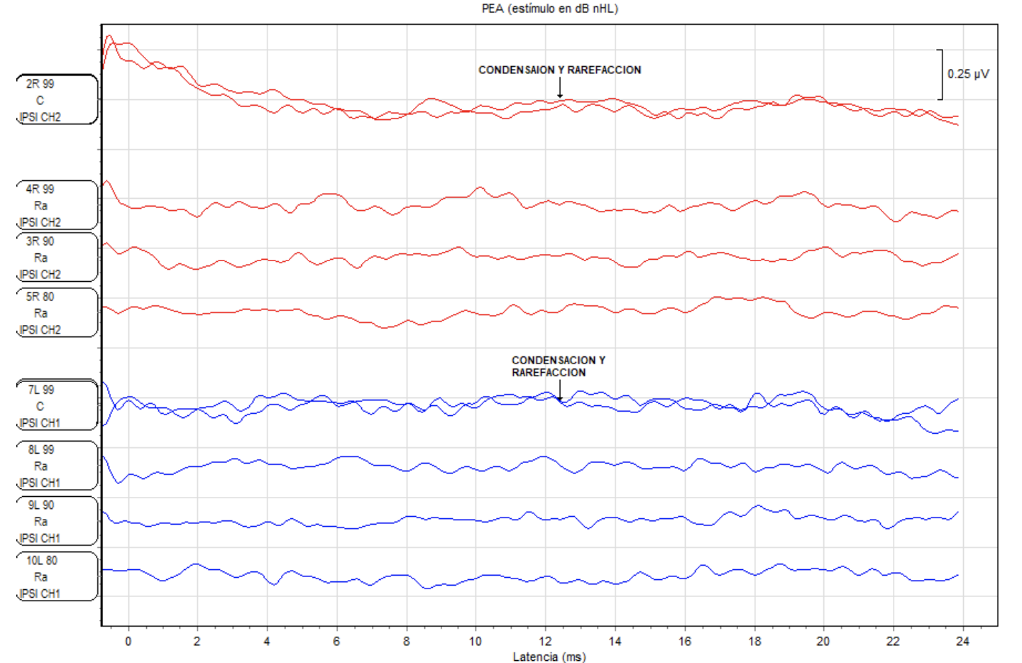 Gráfico de líneas con múltiples curvas en rojo y azul, etiquetadas con diferentes valores y frases como 'Condensación y Rarefacción'. La leyenda indica canales de onda de presión y volumen, con ejes que muestran la latencia en milisegundos y valores en microvoltios.