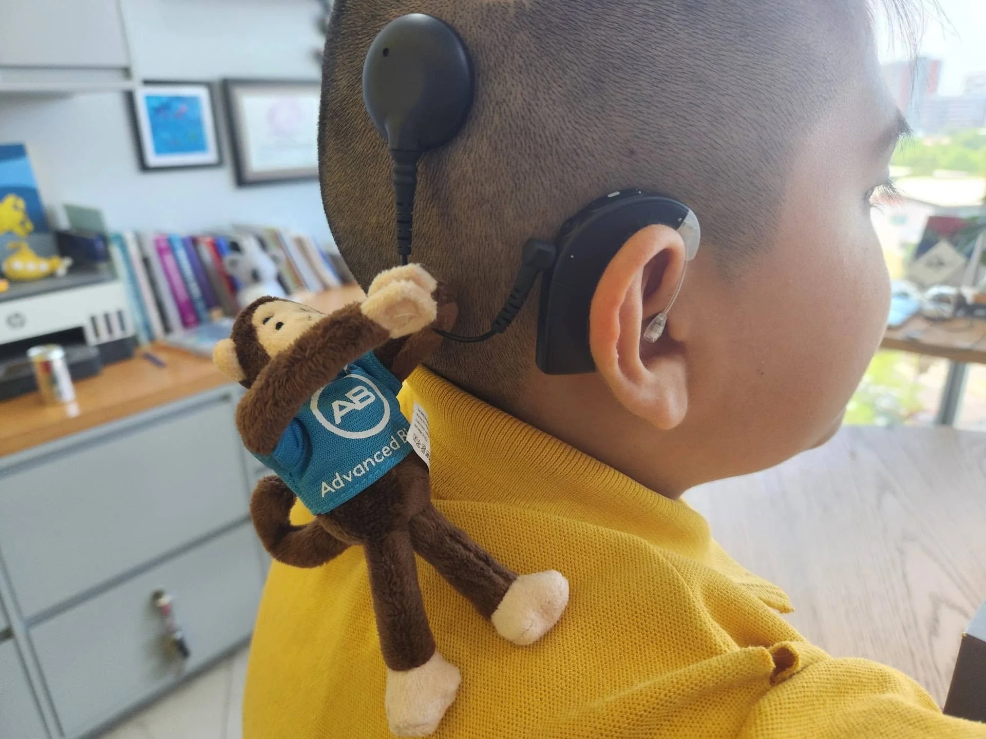 implente coclear en guadalajara