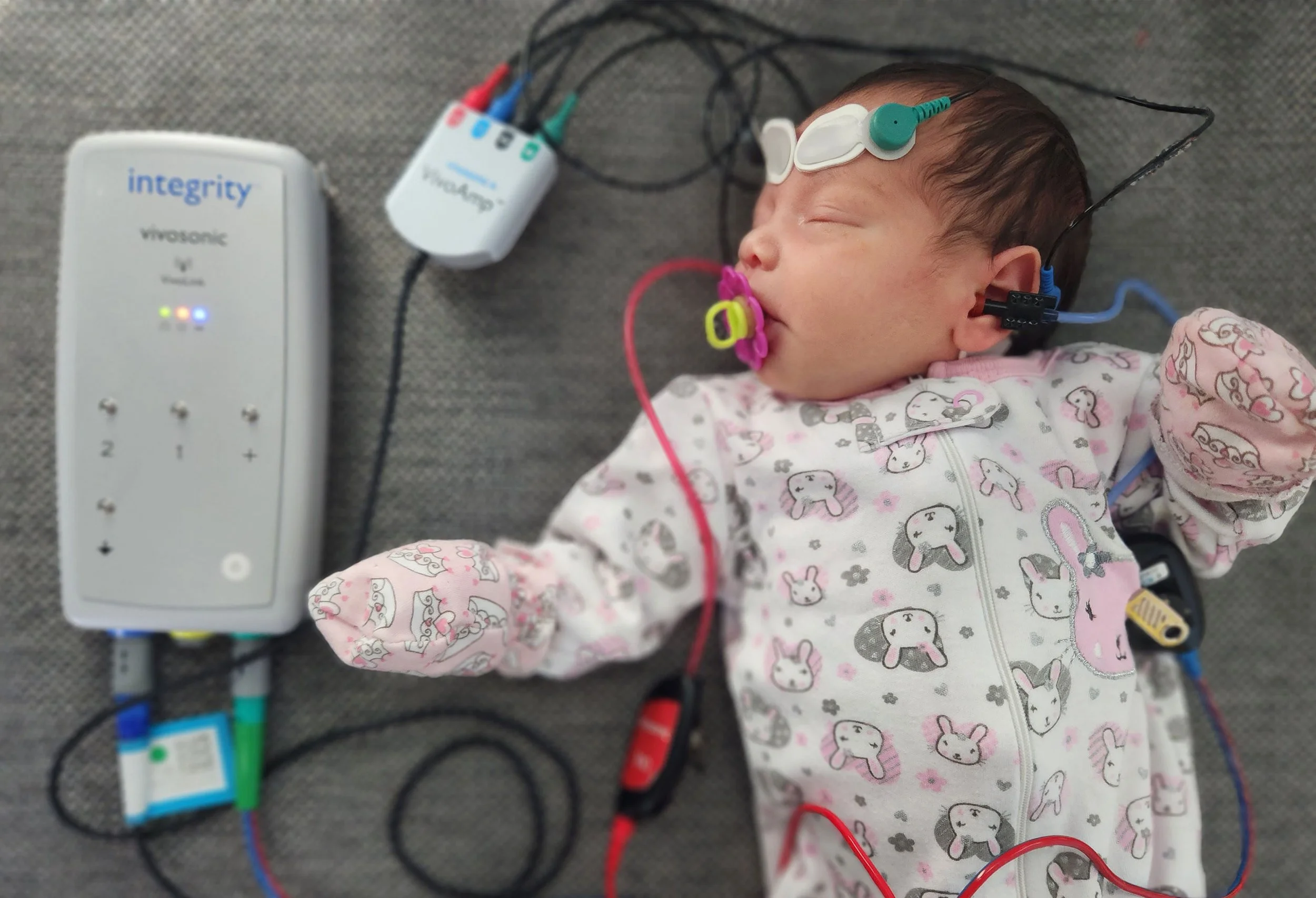Bebé acostado con equipo médico y cables, usando una bata de dibujos de conejos y ositos, con parches en la cabeza y un tubo en la boca, en un contexto hospitalario.