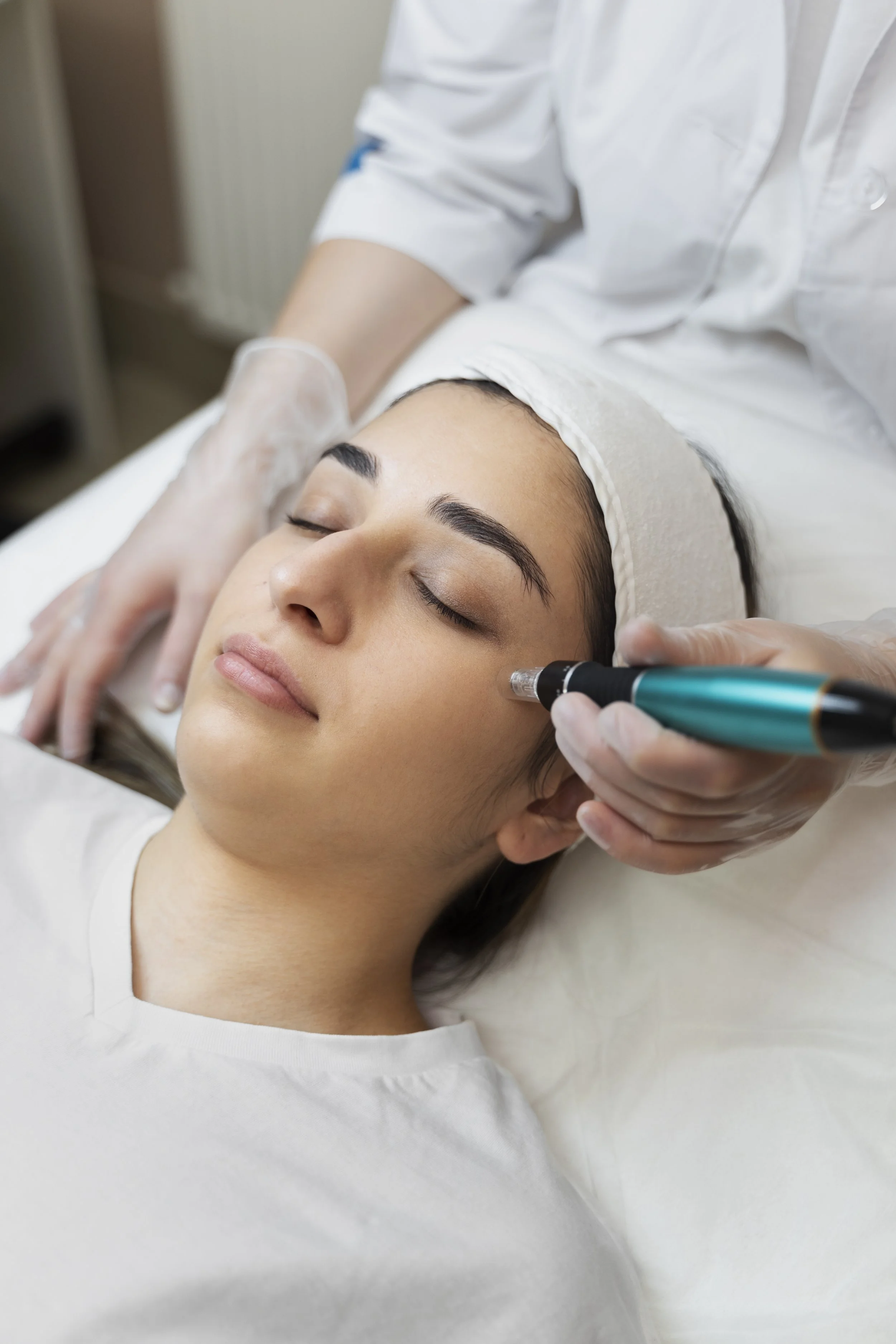 Expert micro-needling services available for skin rejuvenation at Namis Beauty, Bradley Stoke, Bristol