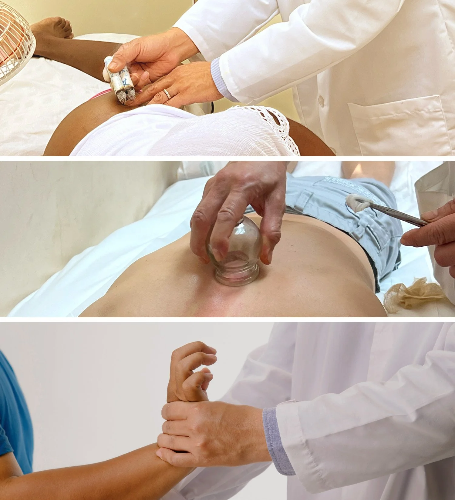 Composite image showcasing various Traditional Chinese Medicine (TCM) modalities, including Tui Na massage, cupping cups, and moxibustion sticks.