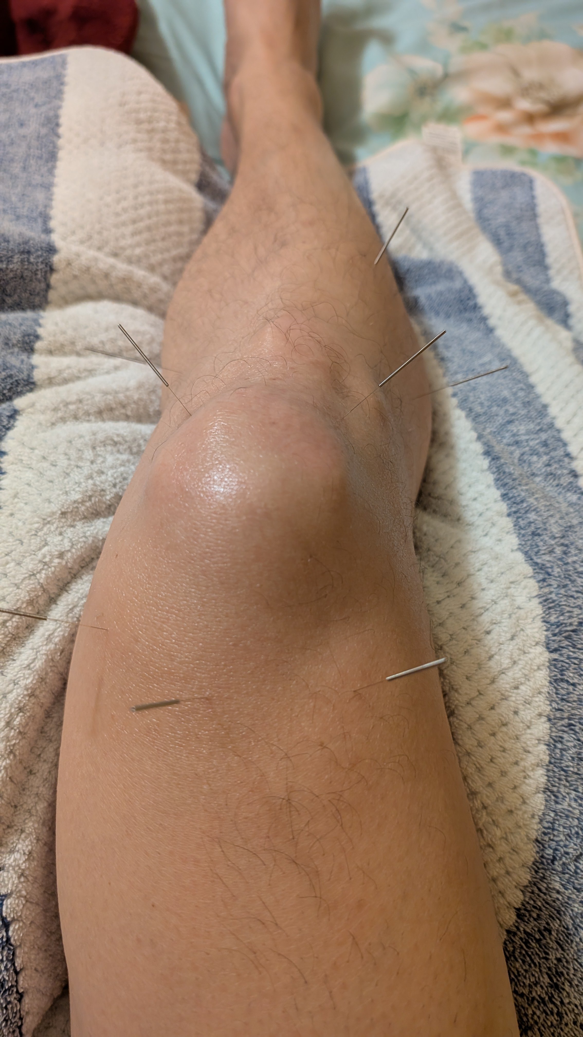 打得更久，比打得更猛更重要