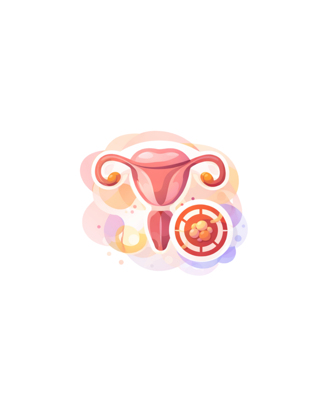 Illustration of a uterus with a spot highlighting a bacterial infection or disease.