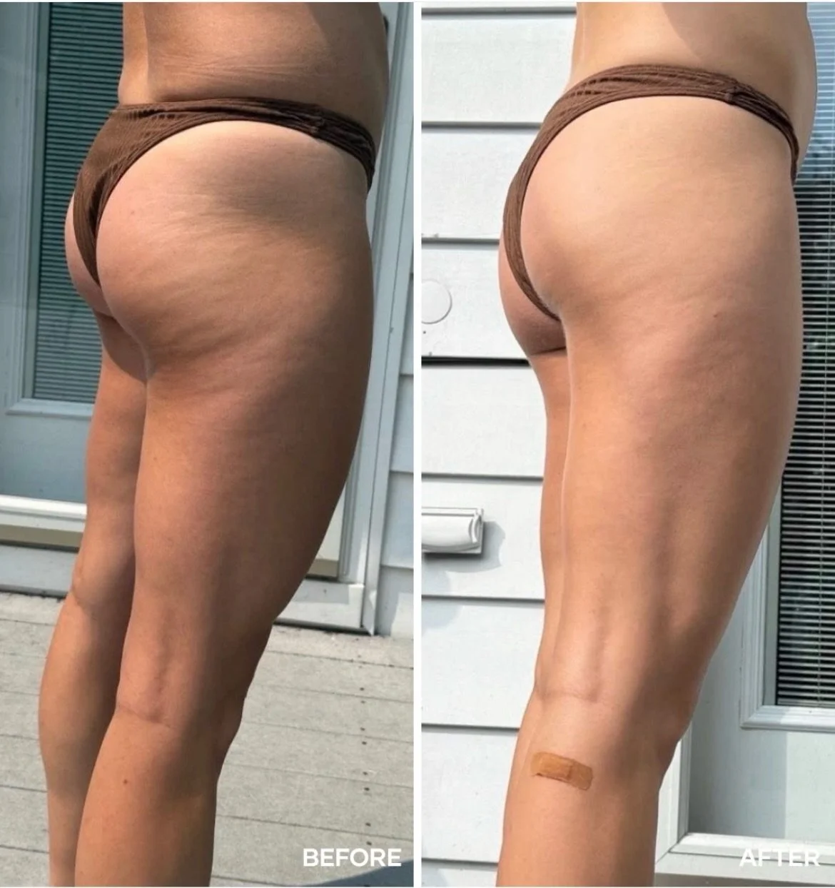 Say less.
We&rsquo;ve all got it, but I&rsquo;ve been trialling the original Shape formula before this product launched into the ANZ market and it&rsquo;s a game changer for smoothing out cellulite and skin tone. My waist is also more snatched with a