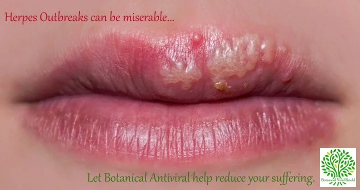 Cold sore image w words.jpg