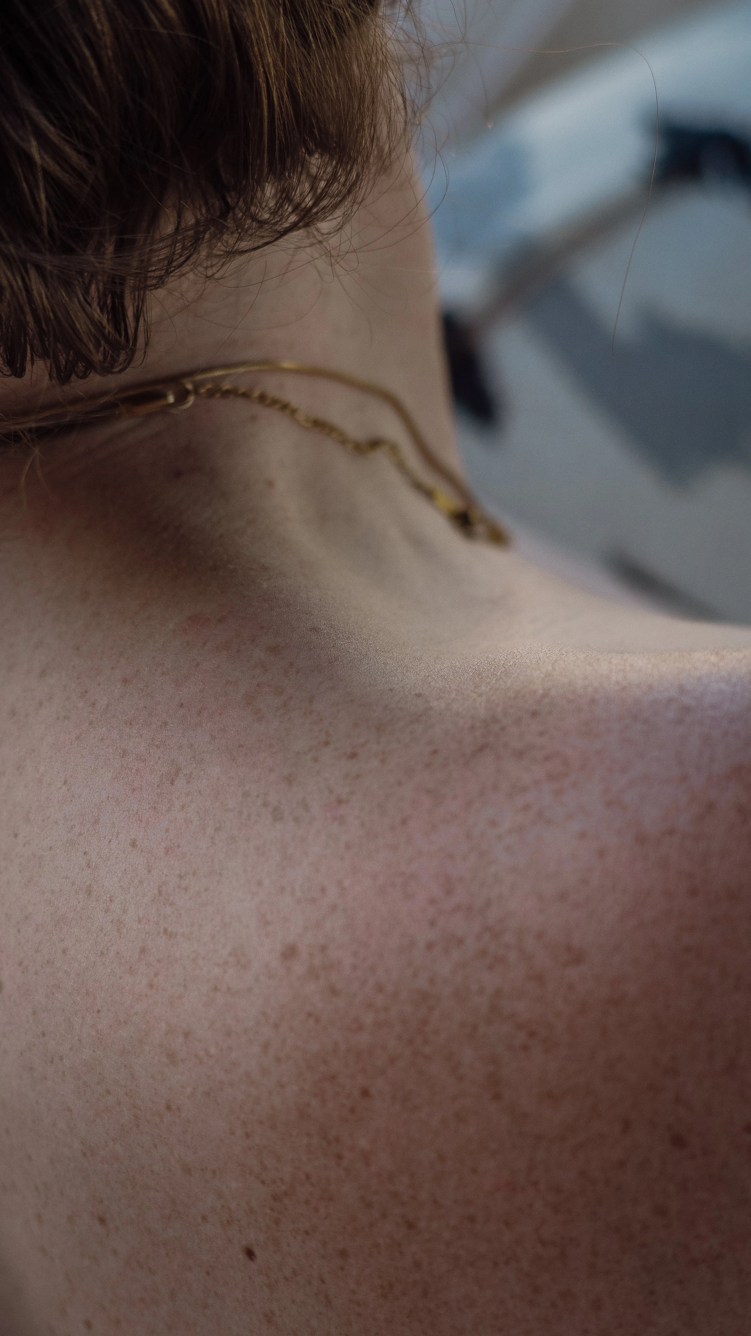 Close-up of a person's neck and shoulder, showing light skin with freckles, wearing a gold chain necklace.