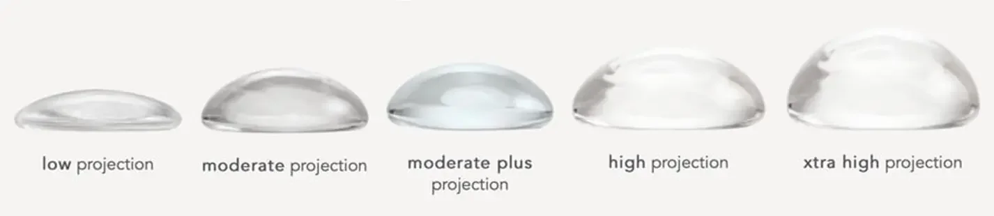 projeção de implantes