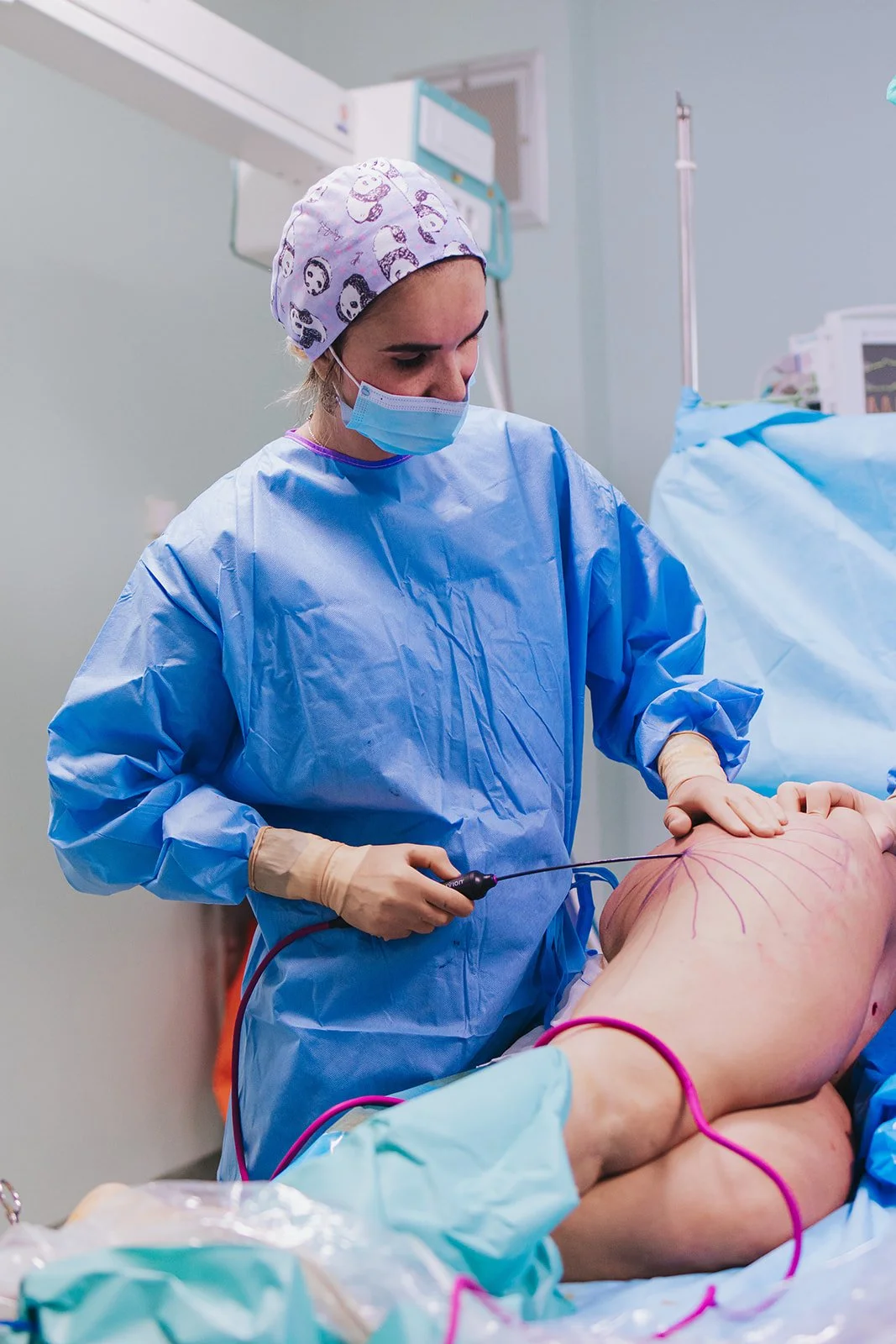 cirurgia de lipedema