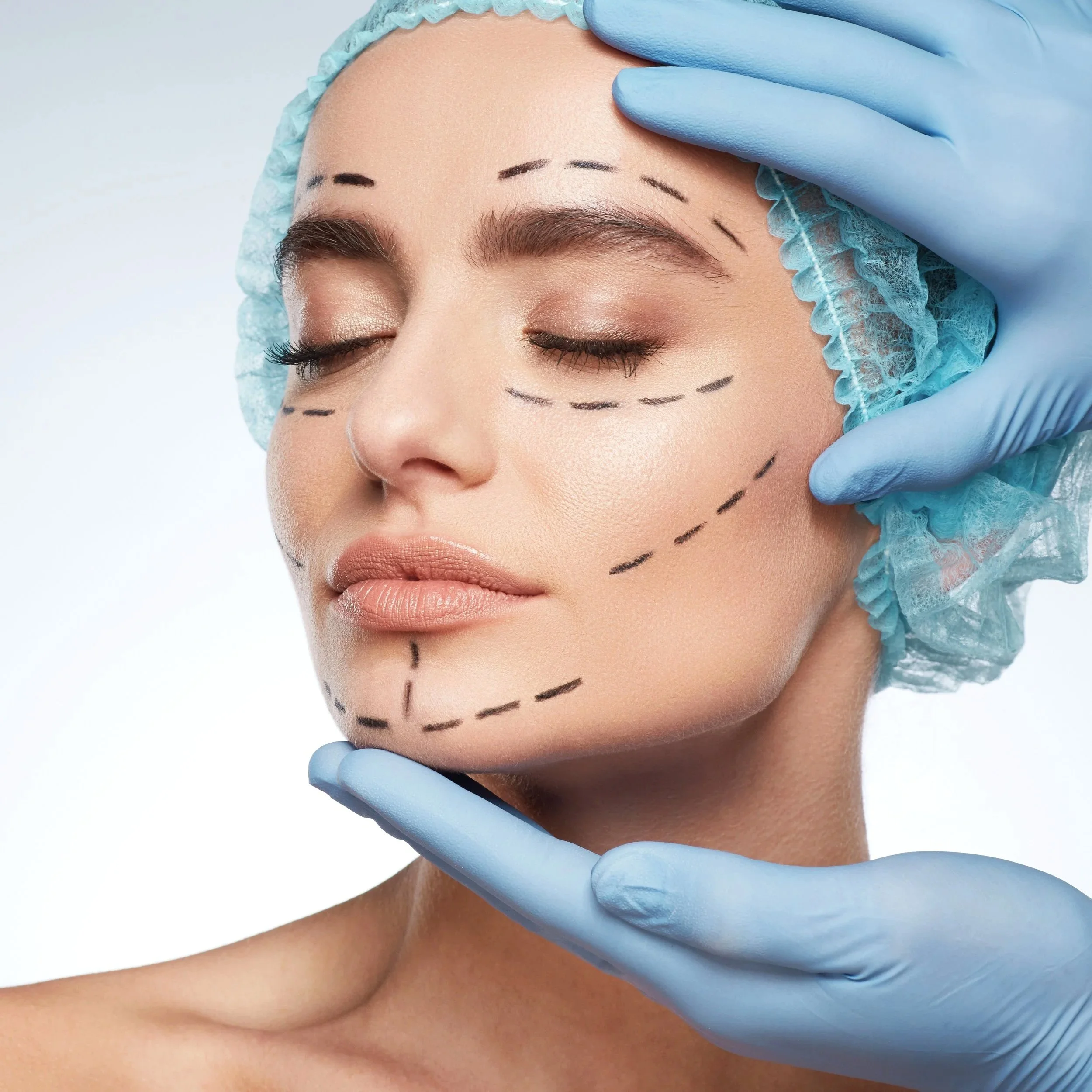 A woman with a surgical cap and closed eyes, having markings on her face made by a medical professional wearing blue gloves, preparing for cosmetic surgery.