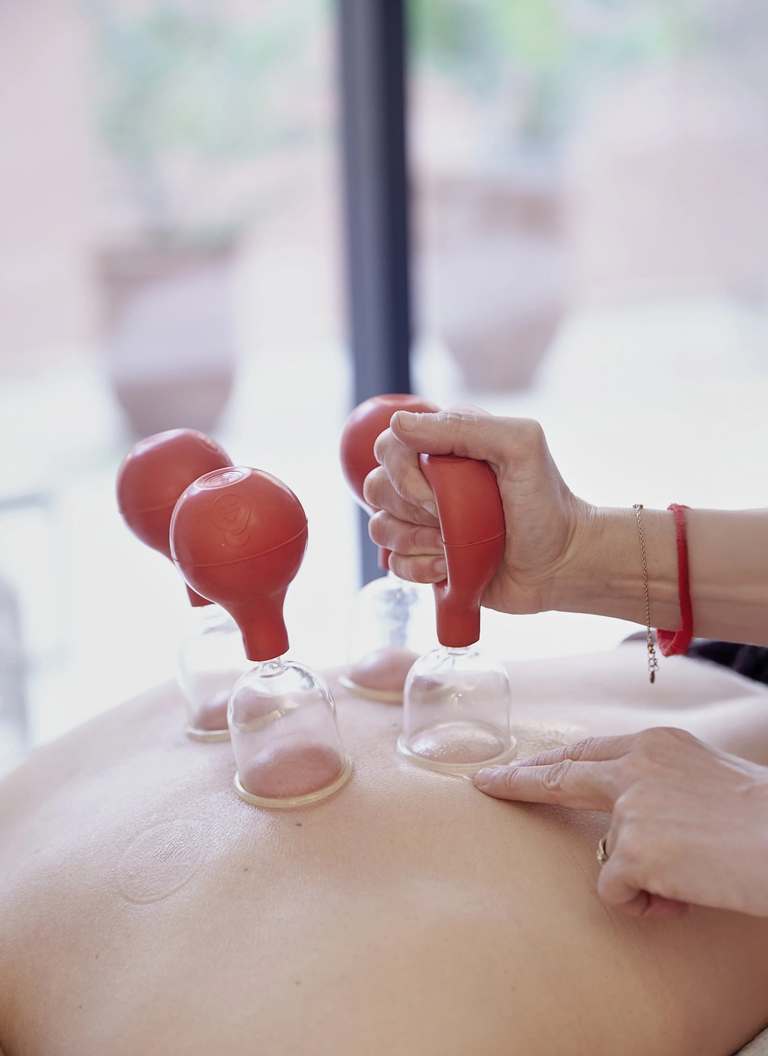 A person receiving cupping therapy with several glass cups and rubber suction devices on their back.