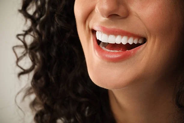 Porcelain Veneers in Germantown, TN: Costs, Benefits, and What to Expect Before You Get Them