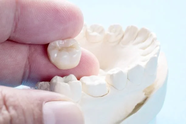 Dental Crowns in Germantown, TN: Cost, Types, Procedure, and When You Need One