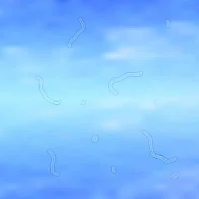 What Are Eye Floaters?