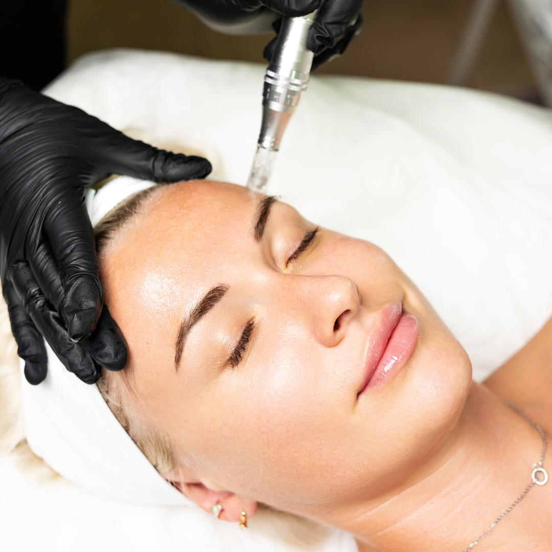 Medspa in Goodyear, AZ 85338 l Microneedling Near Me