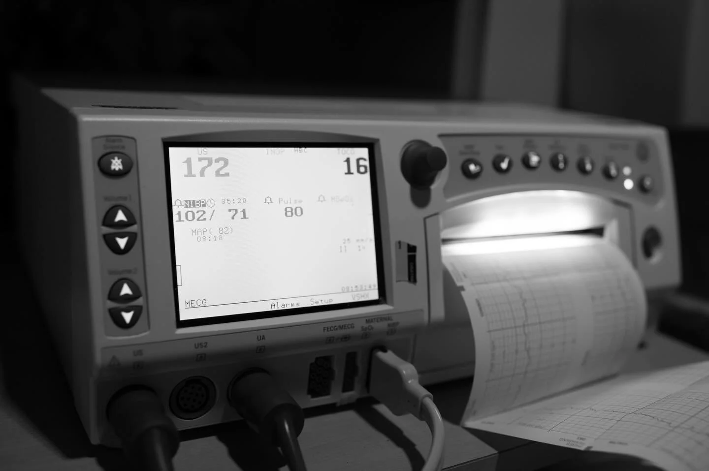 Years ago I was privileged to photograph the delivery of my friend&rsquo;s niece. I was a Labor and Delivery RN at the time and was lucky enough to personally know the team in the OR. Although I had participated in many c-sections before, this one al