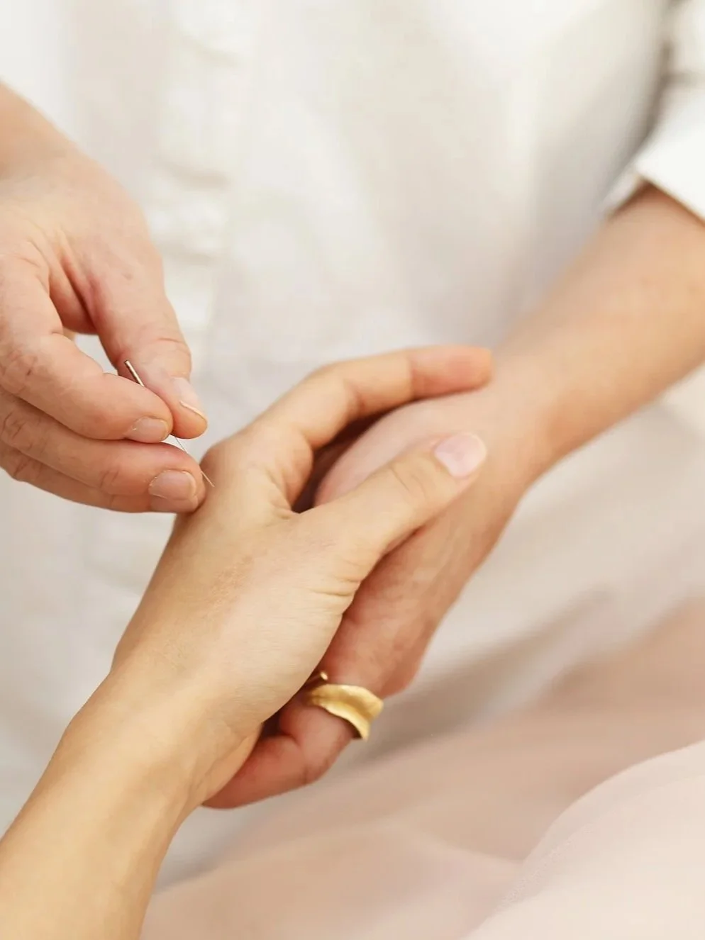 Behandling med akupunktur for smerter og spændinger