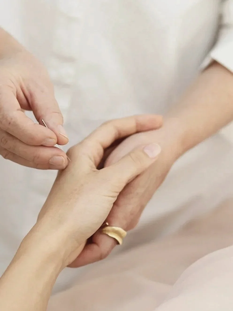 Akupunkturbehandling af smerter i hånd hos akupunktør i Aalborg