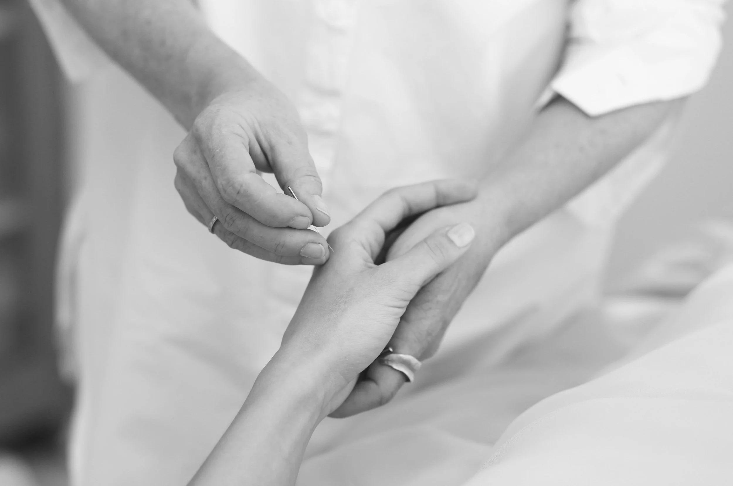 Akupunkturbehandling af smerter i hånd hos akupunktør i Aalborg