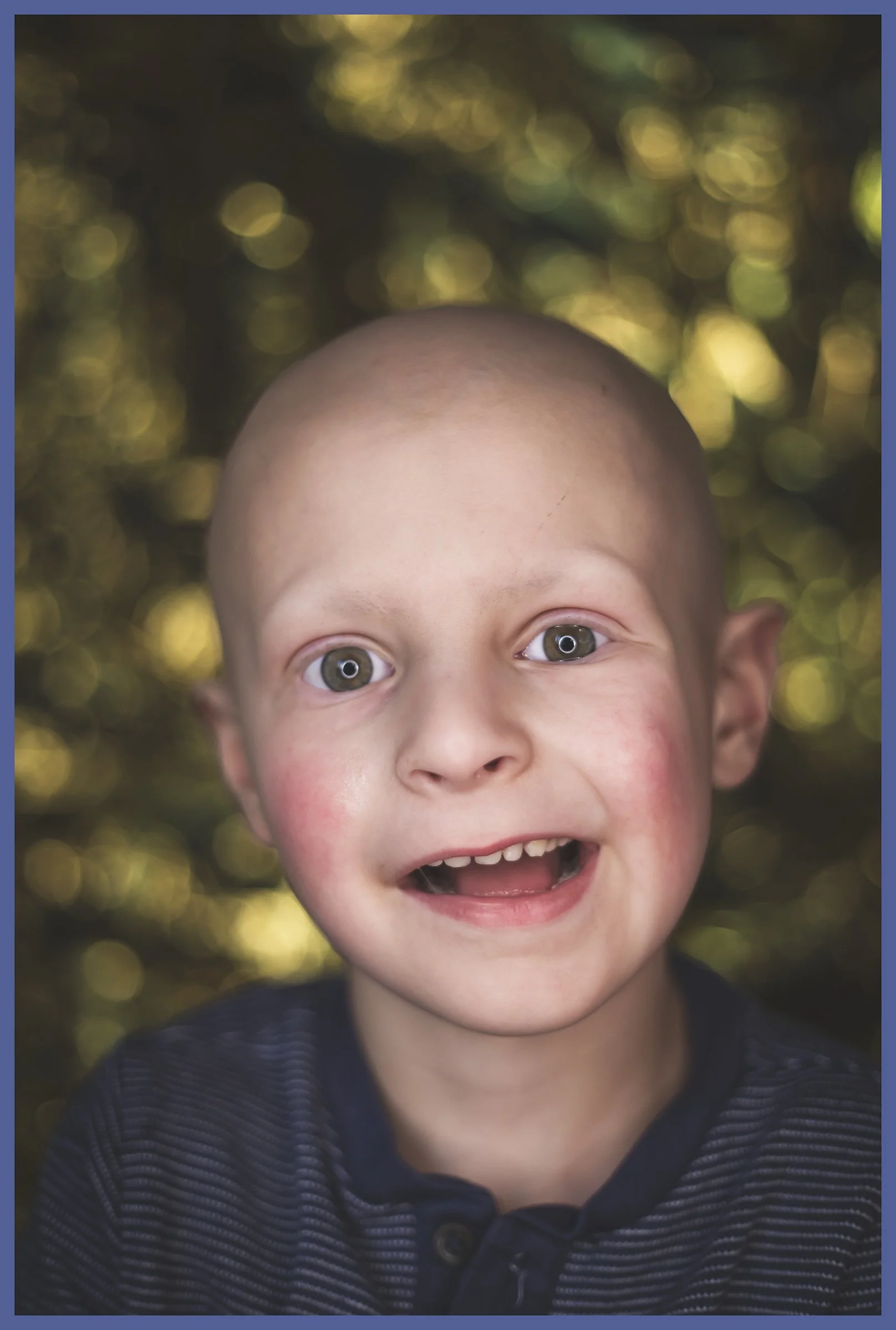 A young child with a bald head and big, expressive eyes smiling and showing two front teeth, outdoors with a bokeh background of green and yellow foliage.