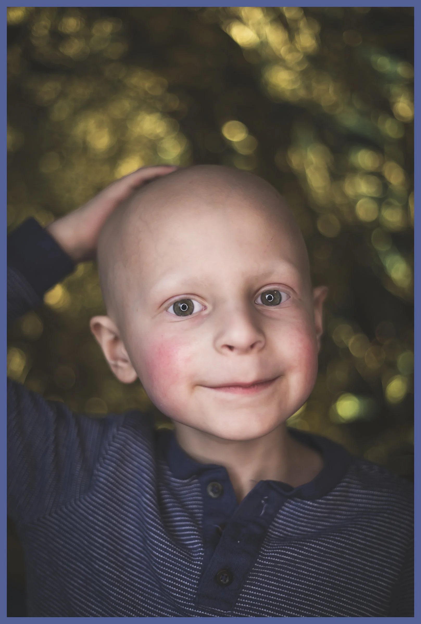 A young boy with a bald head  looks at the camera with a slight smile, touching the top of his head with one hand. He is wearing a navy blue shirt with thin white stripes, and the background is blurred with bokeh lights, suggesting an outdoor setting