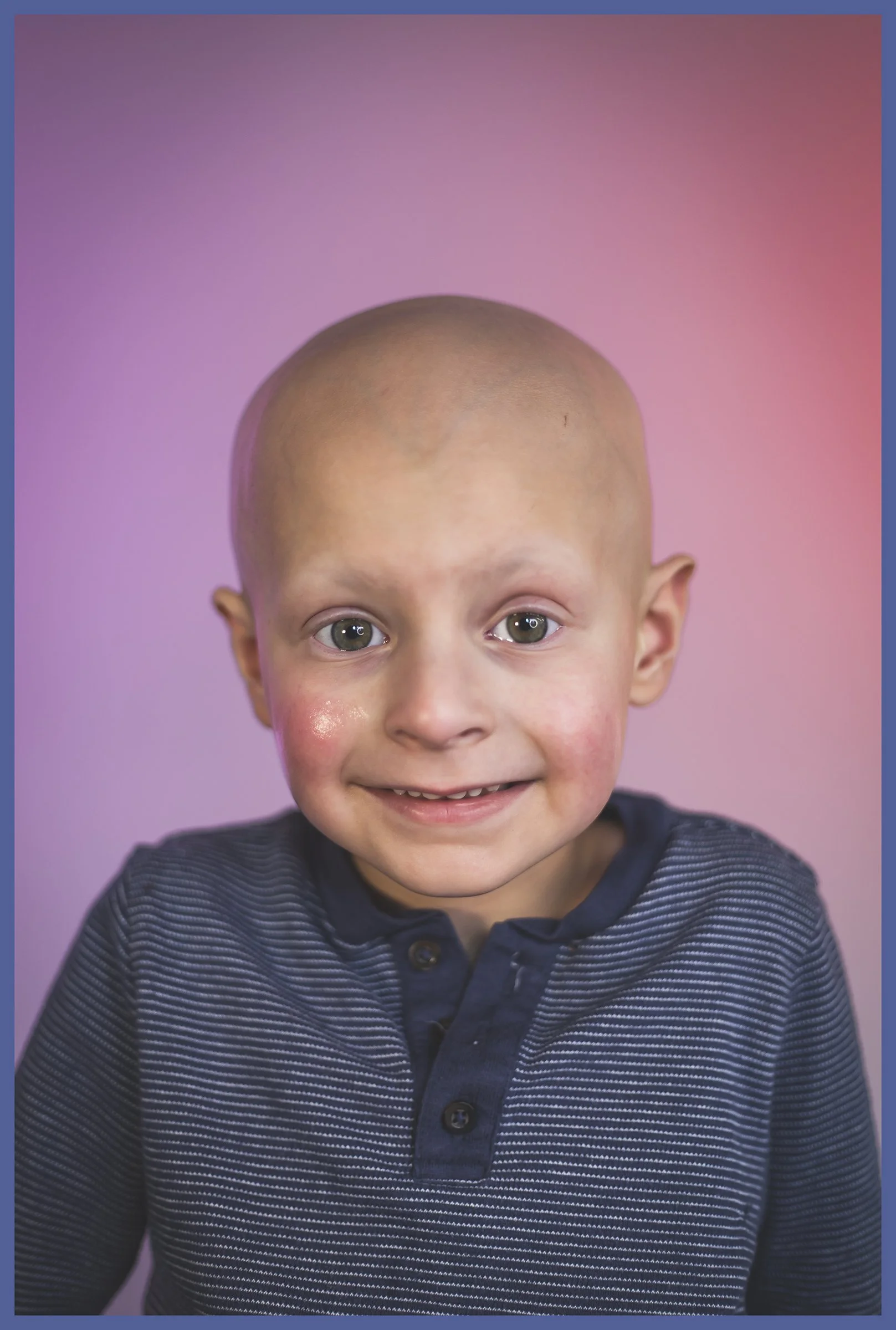 Close-up of a young boy with a bald head, smiling with light-colored eyes, wearing a blue striped shirt, against a pink gradient background.