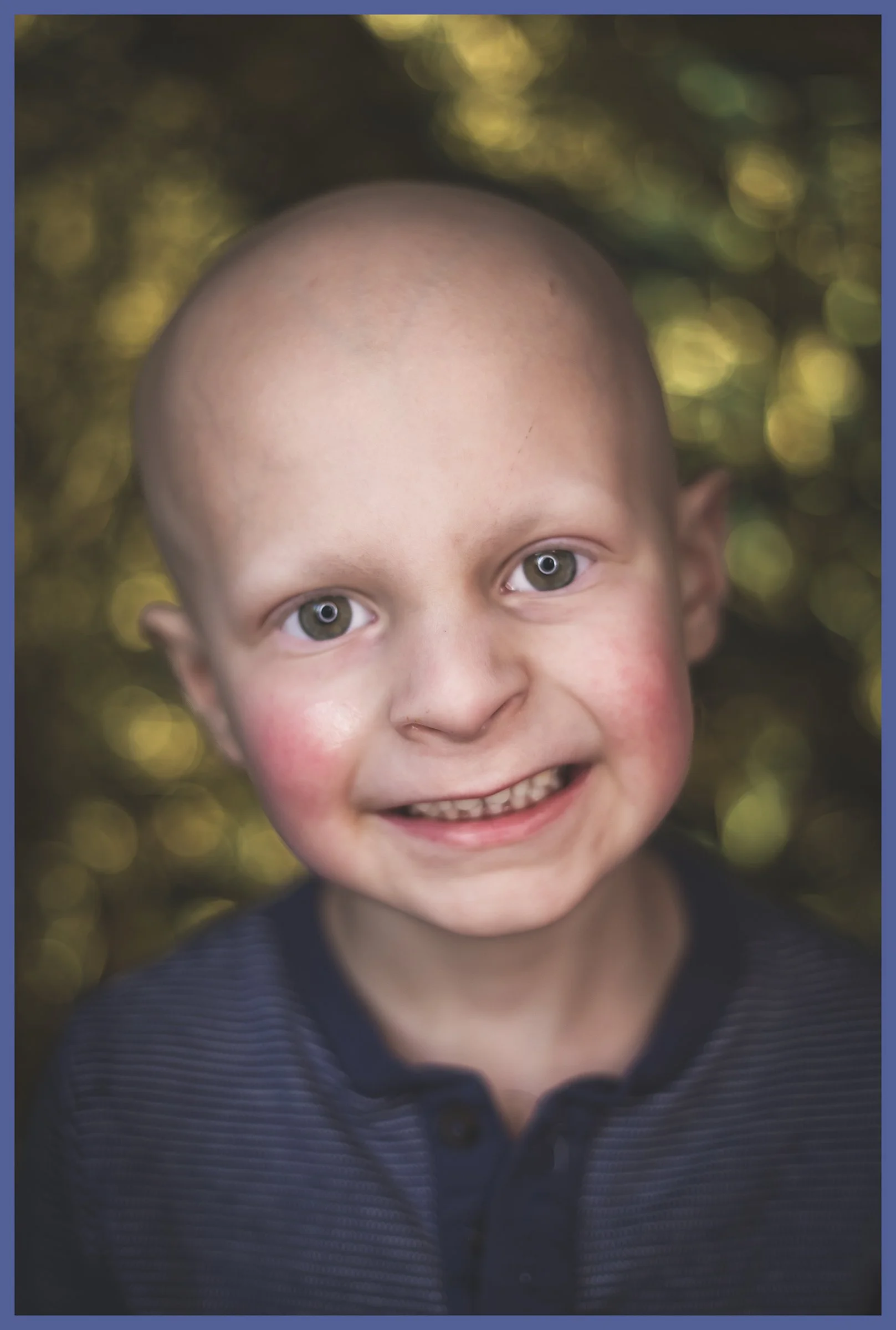 A young boy with a bald head and big, bright eyes smiling at the camera, wearing a dark collared shirt, with a blurred natural background.