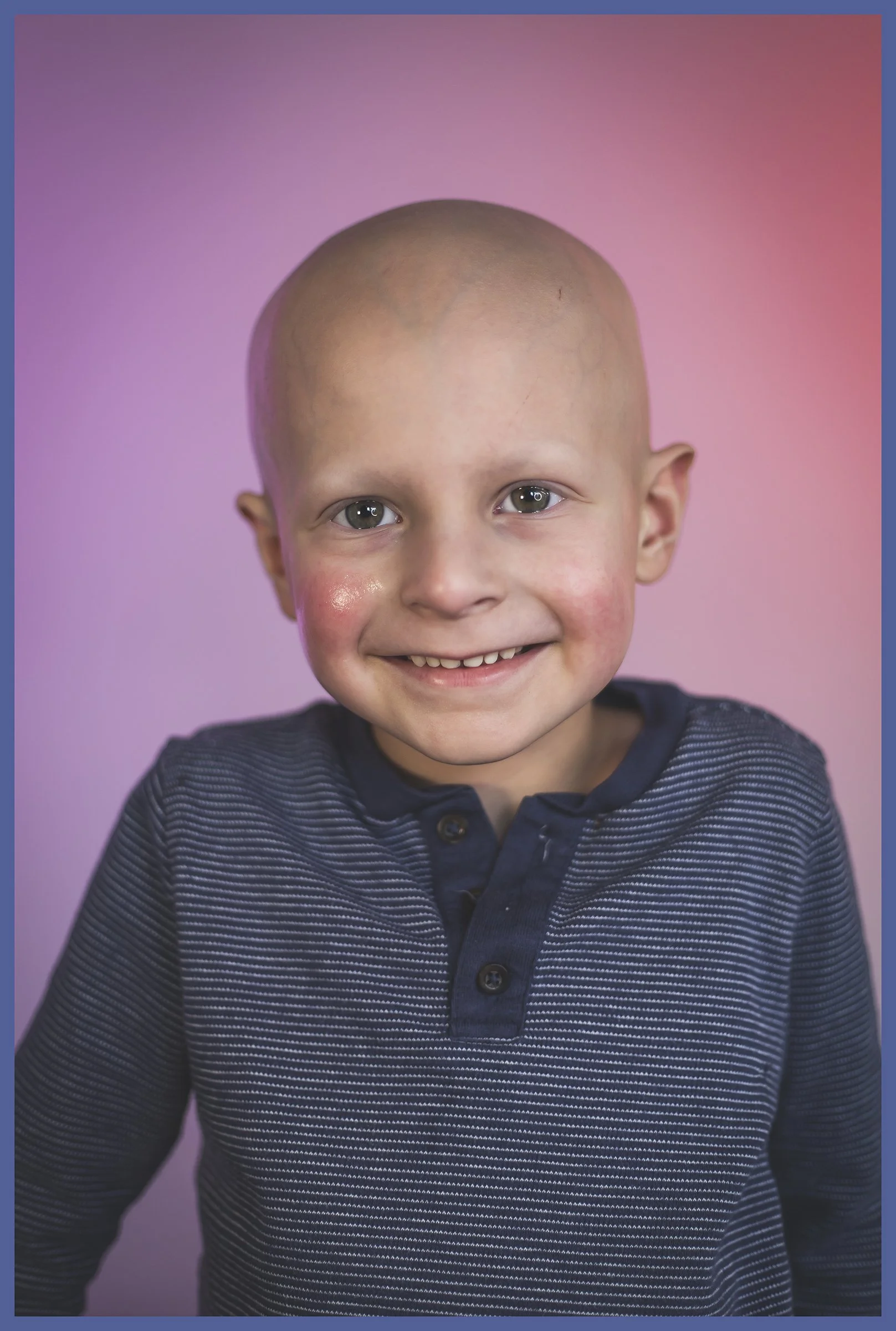 Young boy with a shaved head smiling, wearing a navy striped shirt, against a pink and purple gradient background.