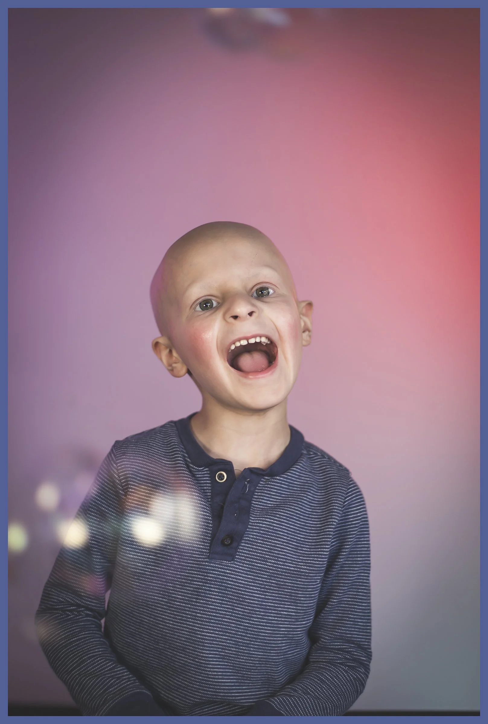 A young boy with a bald head wearing a striped dark blue shirt smiling with his mouth open, against a pink and purple gradient background.