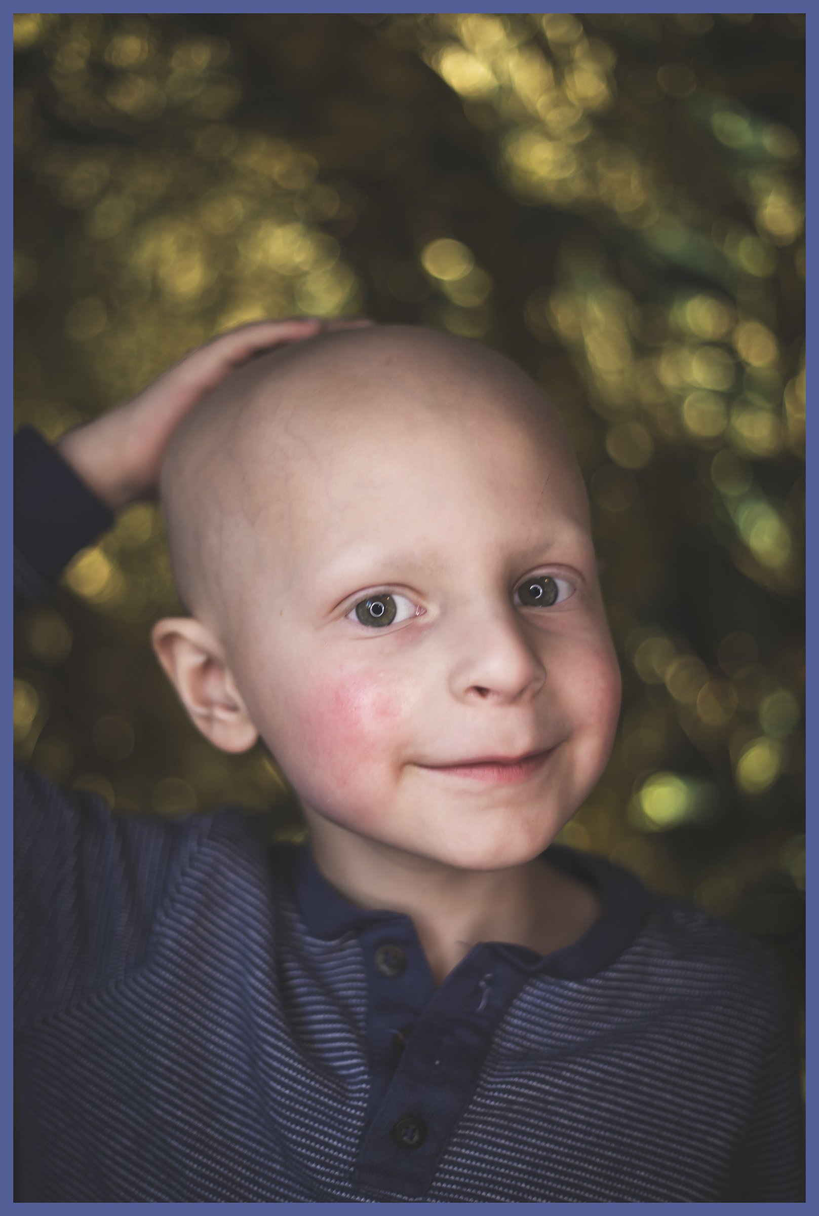 A young boy with a bald head, dressed in a dark striped shirt, smiling and looking into the camera, with a hand touching his head. The background features blurred, golden bokeh lights.
