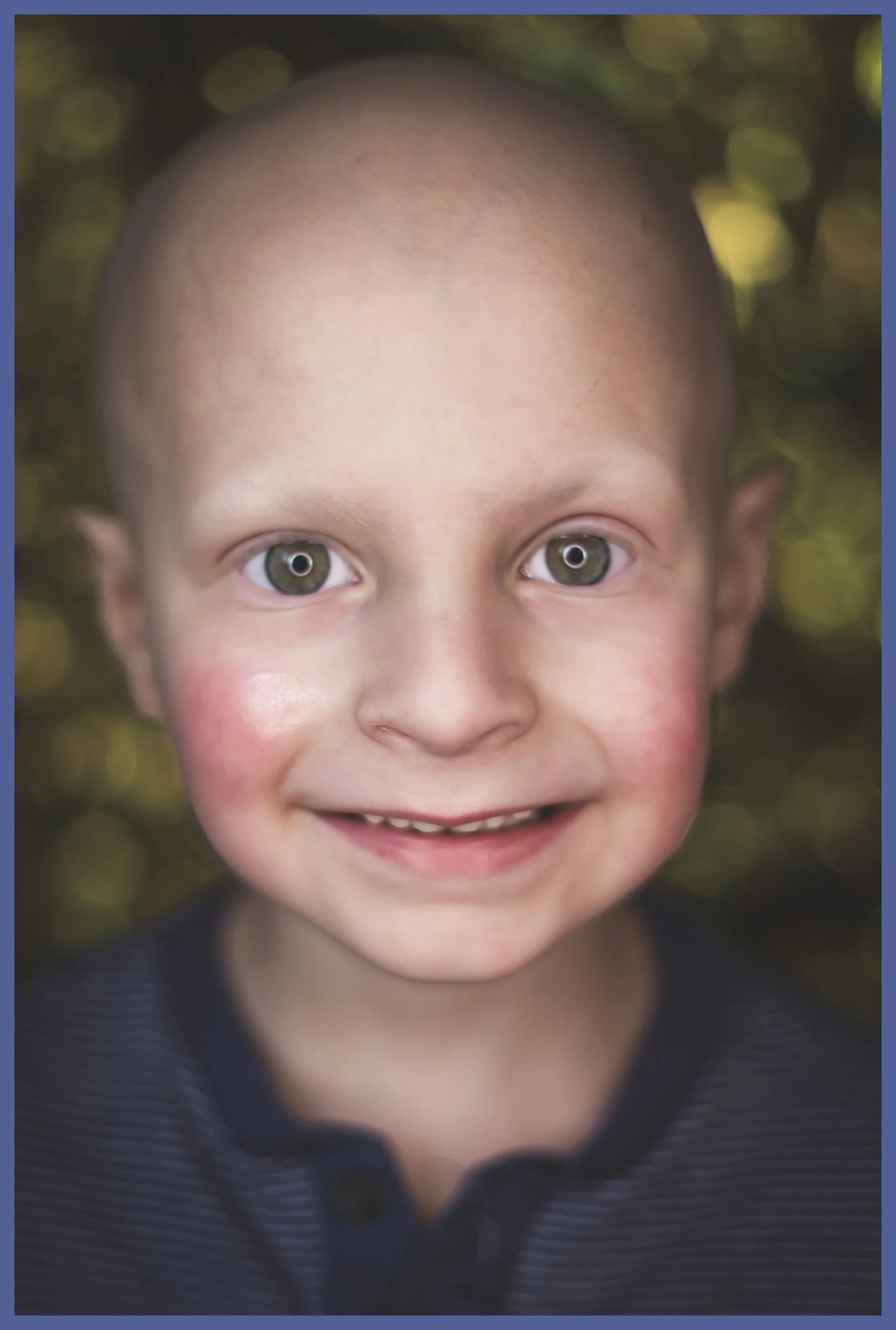 Close-up of a young boy with a bald head, big gray eyes, and a bright smile, wearing a dark shirt with small stripes, with blurred green and gold background.