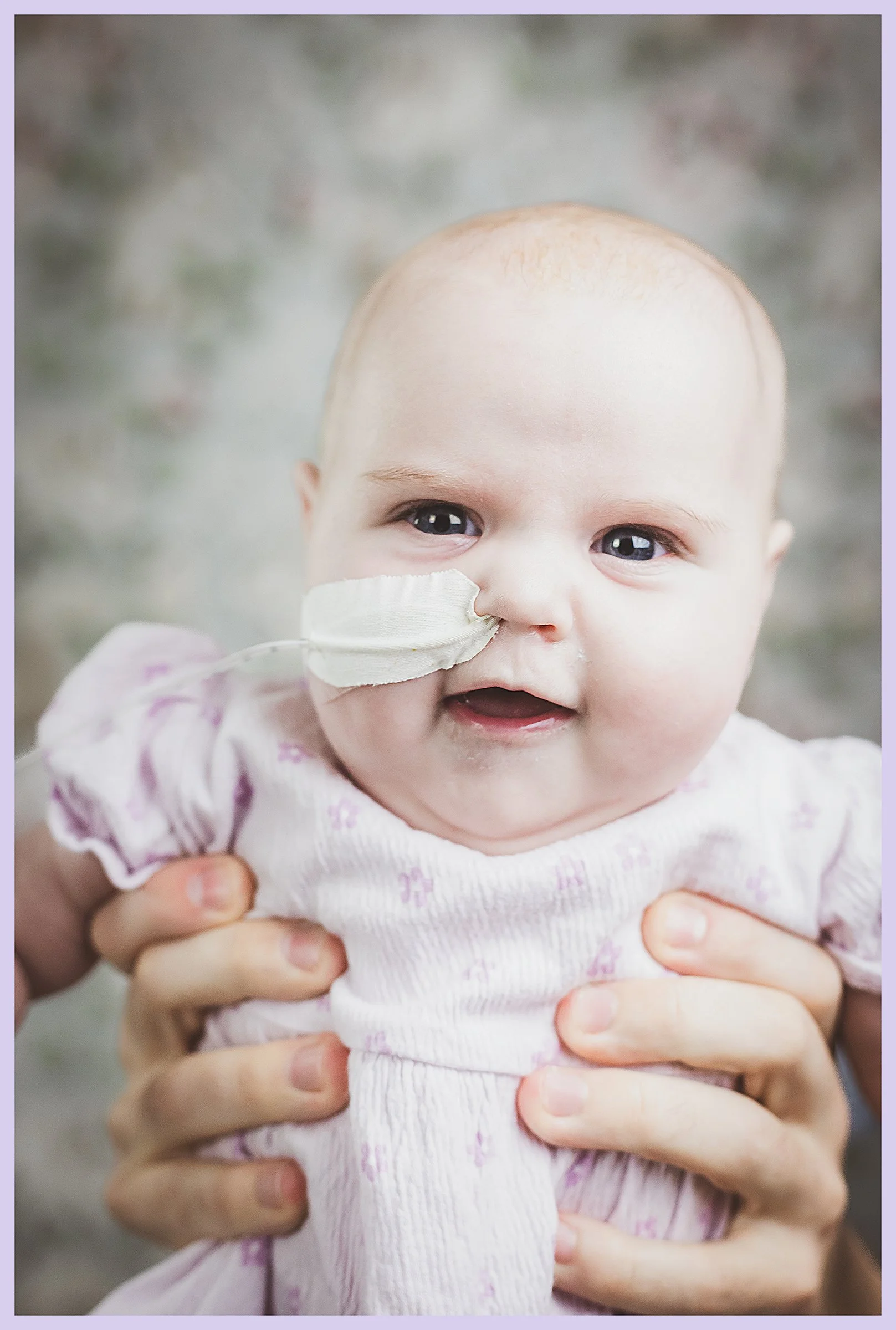 A baby girl with a medical nasal tube, being held by an adult with both hands, wearing a pink and white outfit, with a blurred outdoor background.