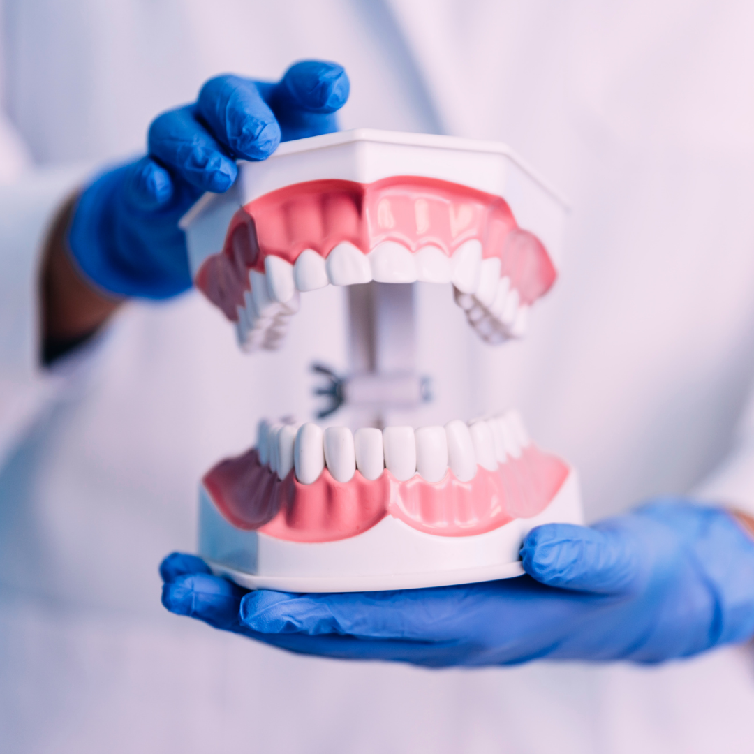 Person wearing blue gloves holding a model of human teeth and gums.