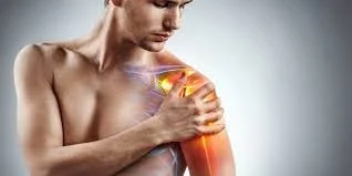 Recovery Time for Torn Labrum in the Shoulder