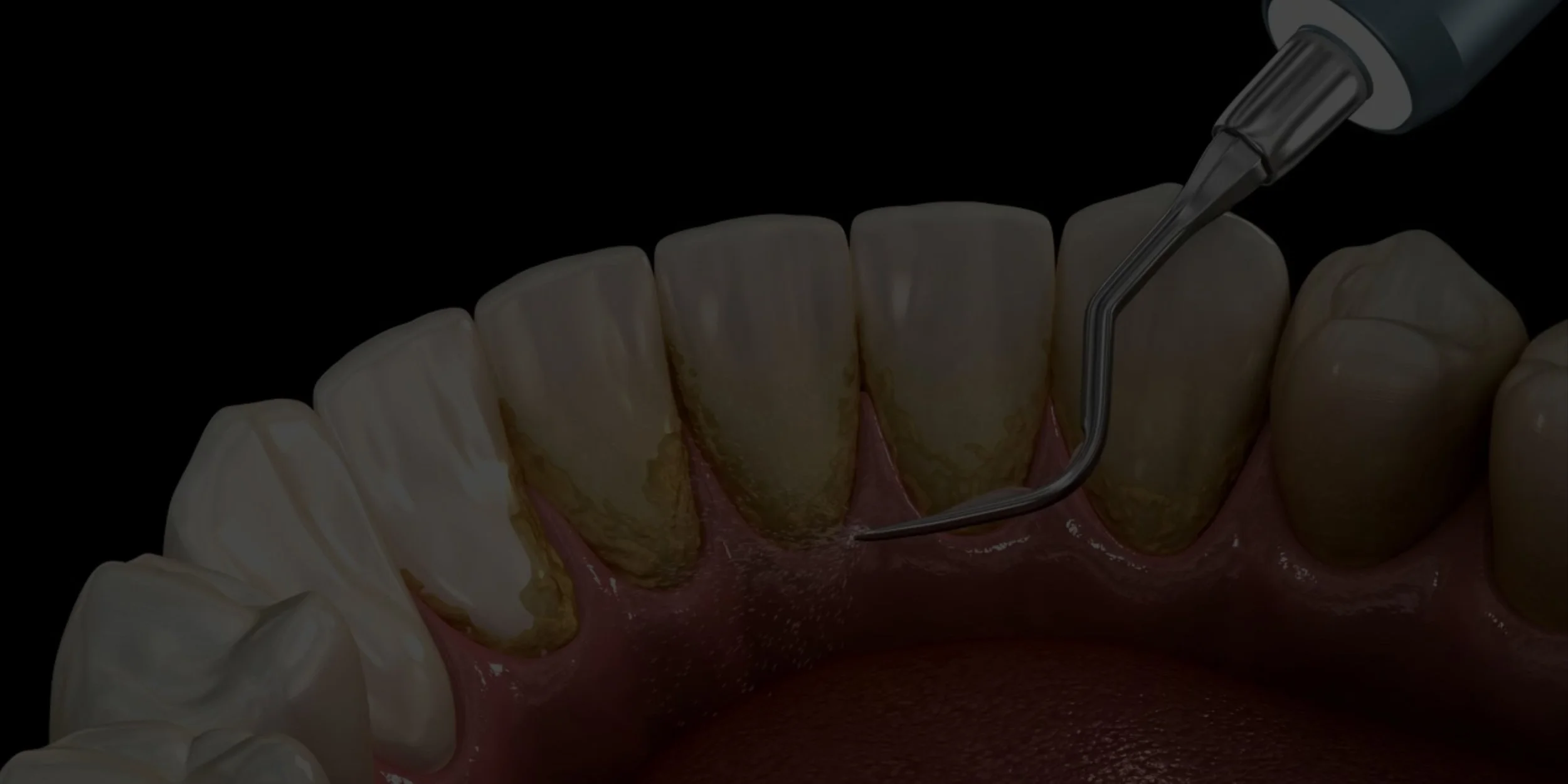 Preventive and General Dental Services.jpg