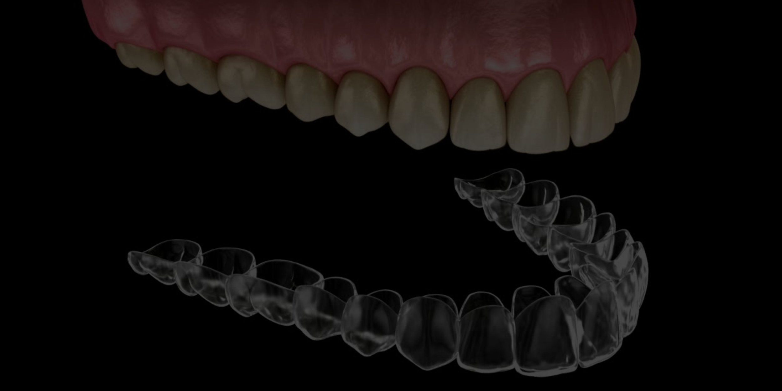 Invisalign.jpg