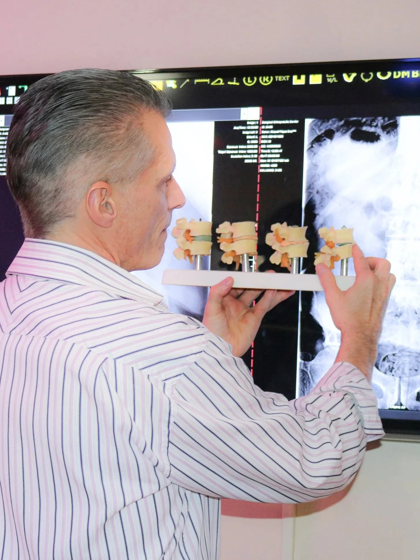 A chiropractor holding a model of the human spine near an X-ray of the spine on a screen.