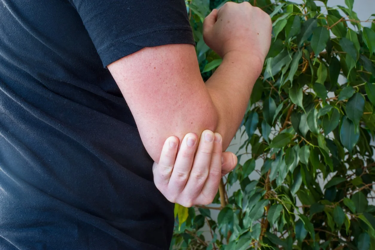 Signs You Might Have a Sports or Repetitive Strain Injury