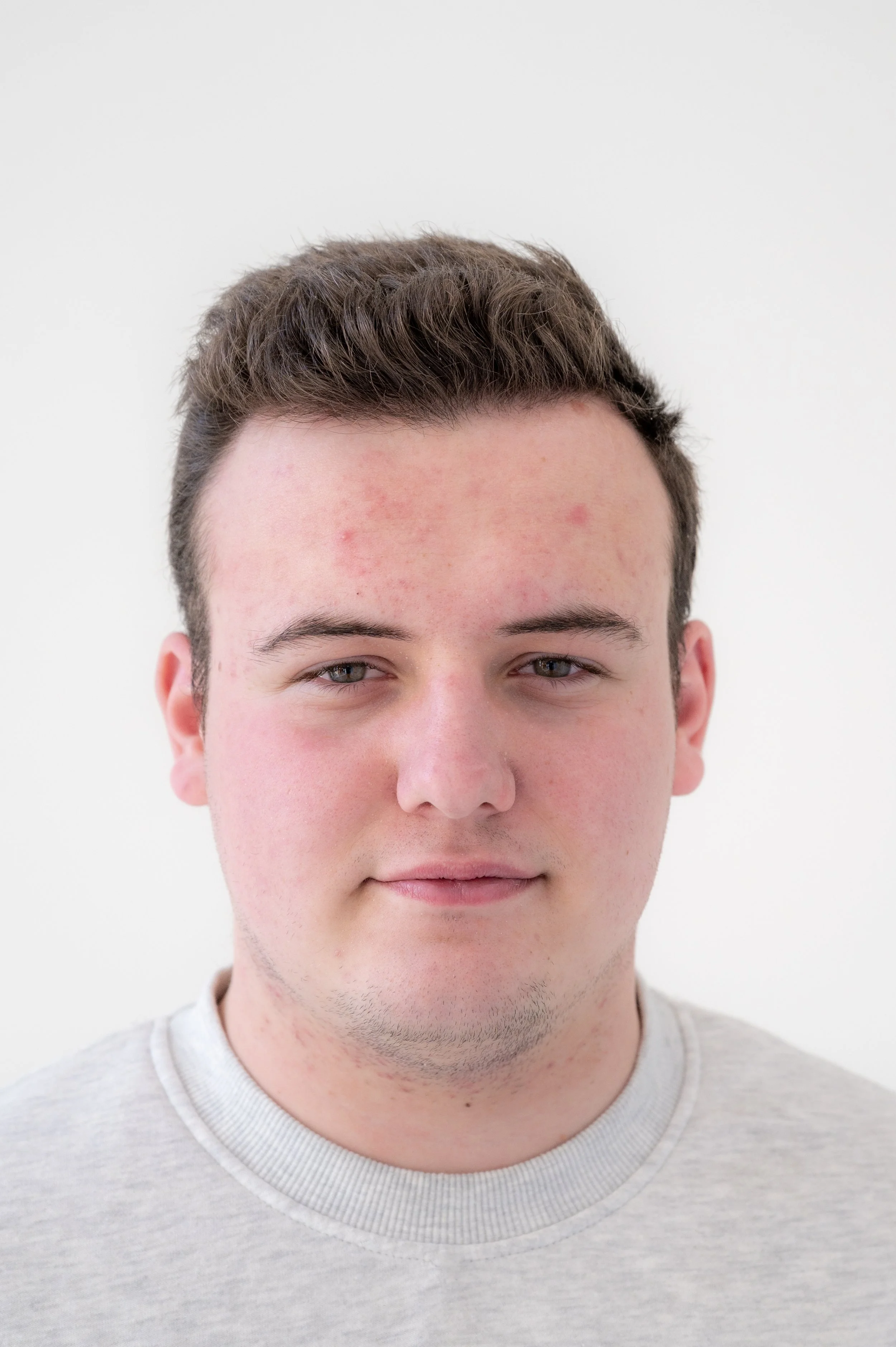 Close-up portrait of a young man with short brown hair, fair skin, and slight facial redness, wearing a light gray crew-neck shirt, against a plain white background.