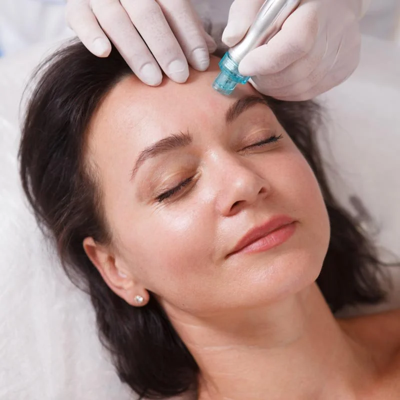 Woman receiving a cosmetic treatment on her forehead with a device held by a professional wearing gloves.